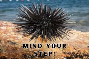 Are Sea Urchins Poisonous - Spiky Urchin